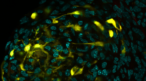 Microscopy image of multicolor labelled acinar cells
